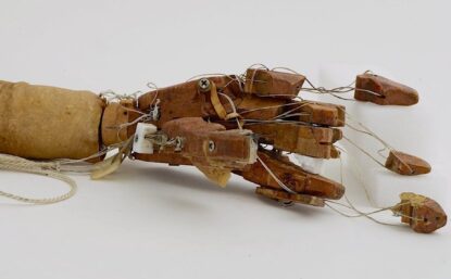 Prosthetic Arm with Strings